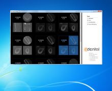 Software for visualization of 3D dental images.