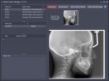 Software for working with X-Ray images. Developed for an international health care corporation.